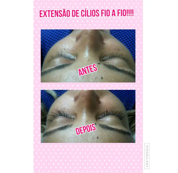 SILVANIA DUARTE ESTETICA - foto 3