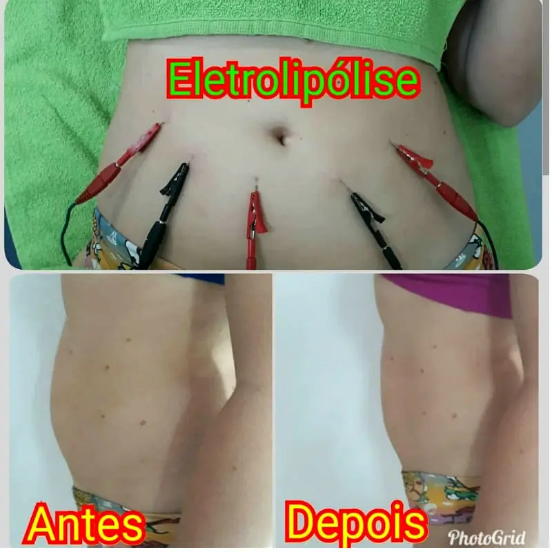 FISI QUALY - foto 4
