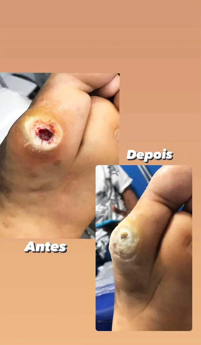 Clinica Saúde dos Pés Betânia Lima Podóloga - foto 4