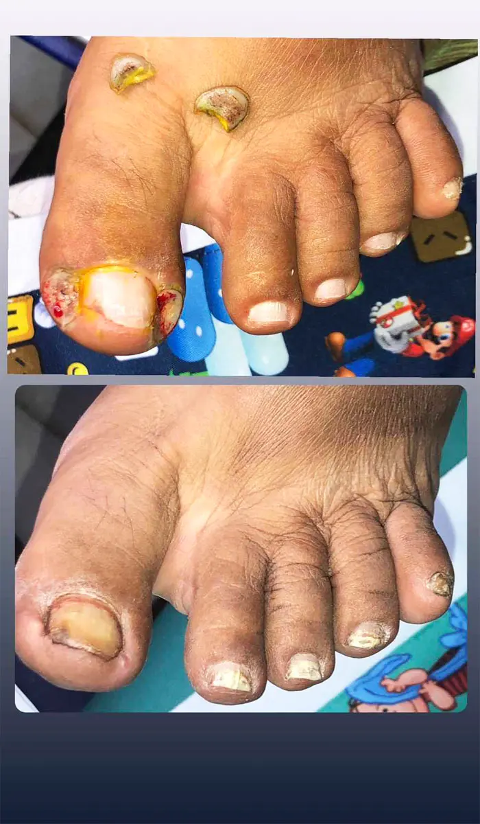 Clinica Saúde dos Pés Betânia Lima Podóloga - foto 5