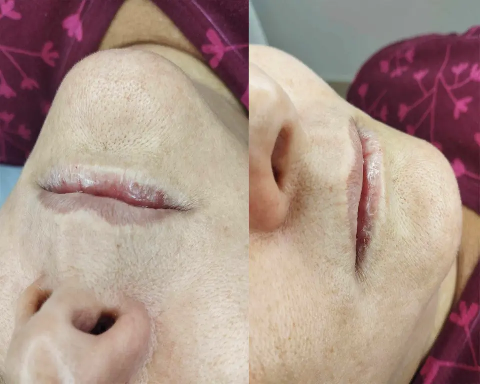 Adri Estética - foto 5